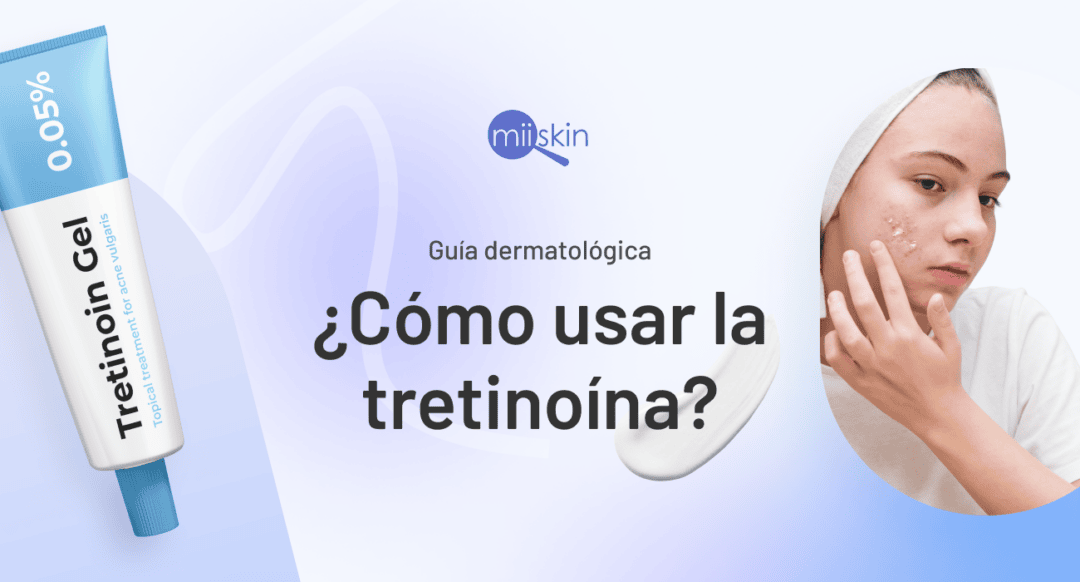 Crema de tretinoína